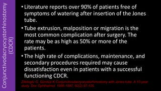 •Literature reports over 90% of patients free of
symptoms of watering after insertion of the Jones
tube.
•Tube extrusion, malposition or migration is the
most common complication after surgery. The
rate may be as high as 50% or more of the
patients.
•The high rate of complications, maintenance, and
secondary procedures required may cause
dissatisfaction even in patients with a successful
functioning CDCR.
Conjunctivodacryocystorhinostomy
(CDCR)
Zilelioglu G, Gündüz K.Conjunctivodacryocystorhinostomy with Jones tube. A 10-year
study. Doc Ophthalmol. 1996-1997; 92(2):97-105.
 
