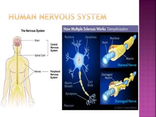 MULTIPLE SCLEROSIS | PPTX