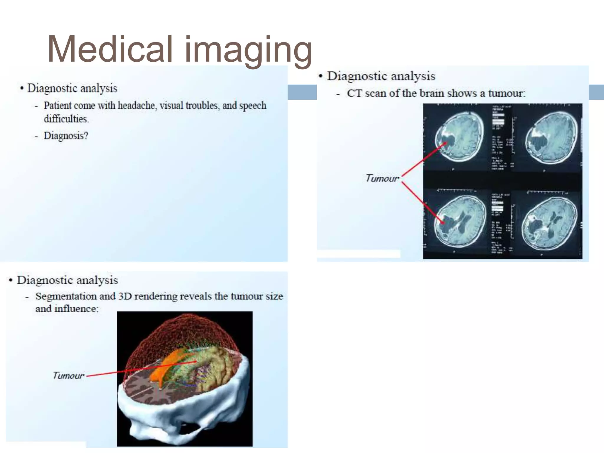Medical imaging
 