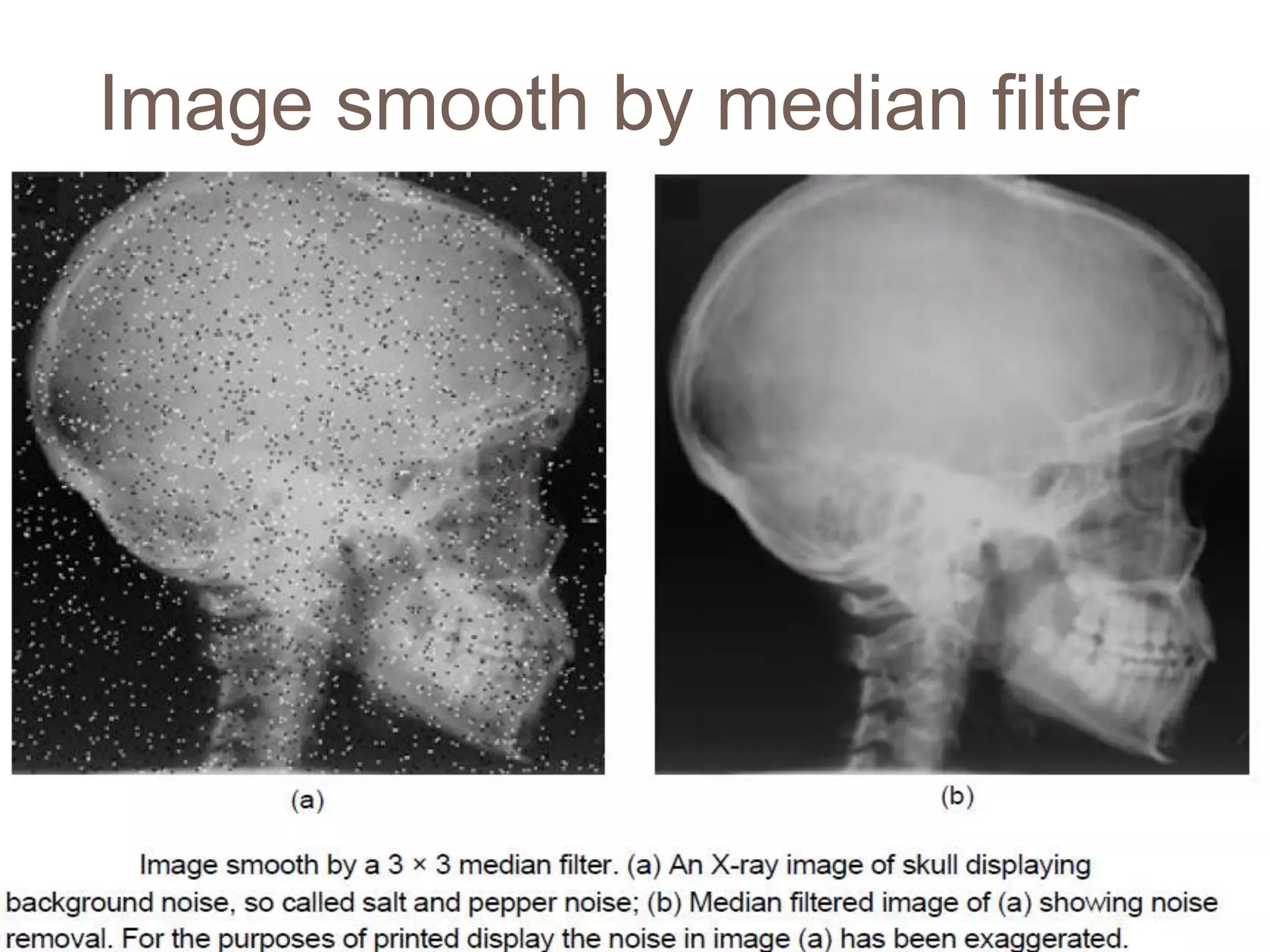 Image smooth by median filter
 