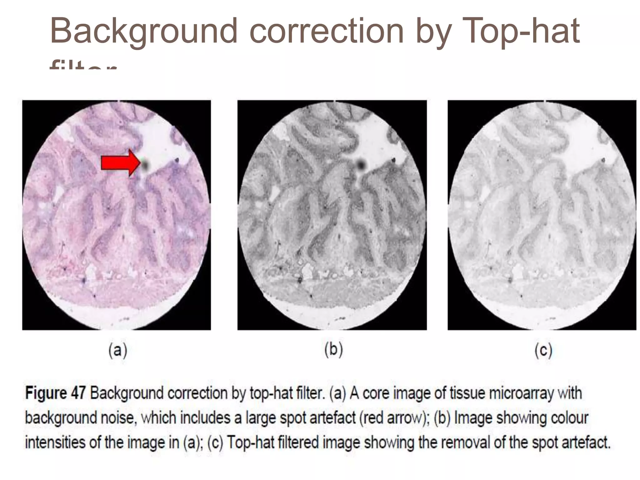 Background correction by Top-hat
filter
 