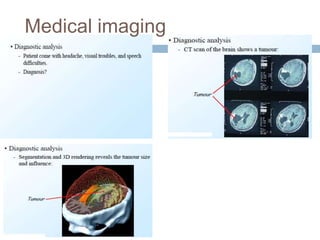 Medical imaging
 