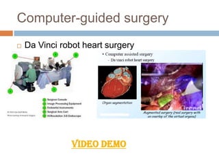 Computer-guided surgery
 Da Vinci robot heart surgery
VIDEO DEMO
 