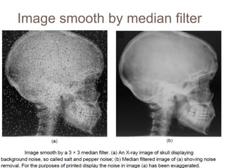 Image smooth by median filter
 