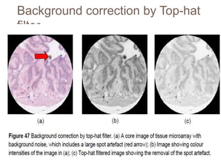 Background correction by Top-hat
filter
 
