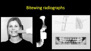 Comprehensive Dental Radiology: Anatomy, Imaging Techniques, and ...