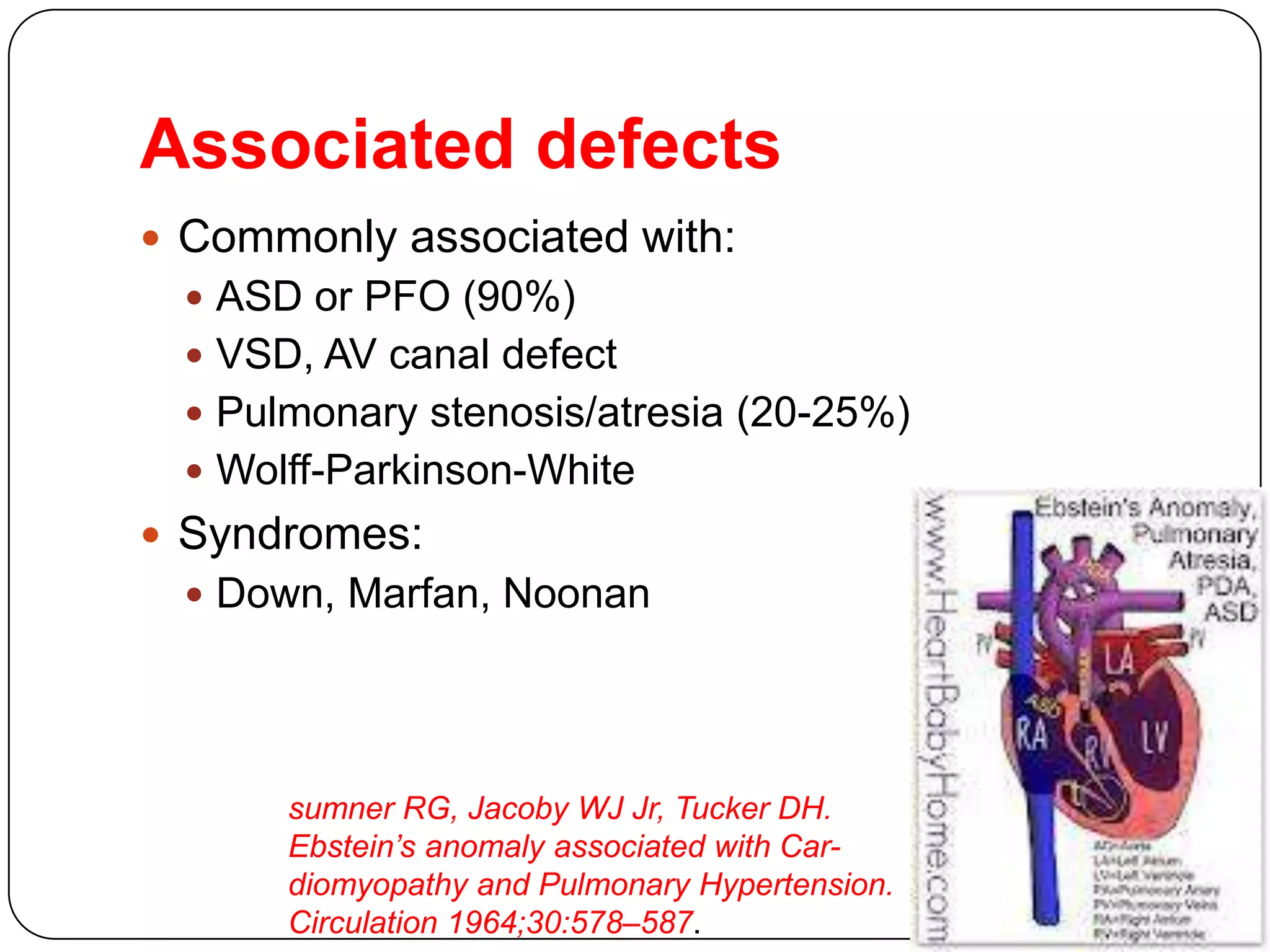 Associated defects
 Commonly associated with:
 ASD or PFO (90%)
 VSD, AV canal defect
 Pulmonary stenosis/atresia (20-25%)
 Wolff-Parkinson-White
 Syndromes:
 Down, Marfan, Noonan
sumner RG, Jacoby WJ Jr, Tucker DH.
Ebstein’s anomaly associated with Car-
diomyopathy and Pulmonary Hypertension.
Circulation 1964;30:578–587.
 
