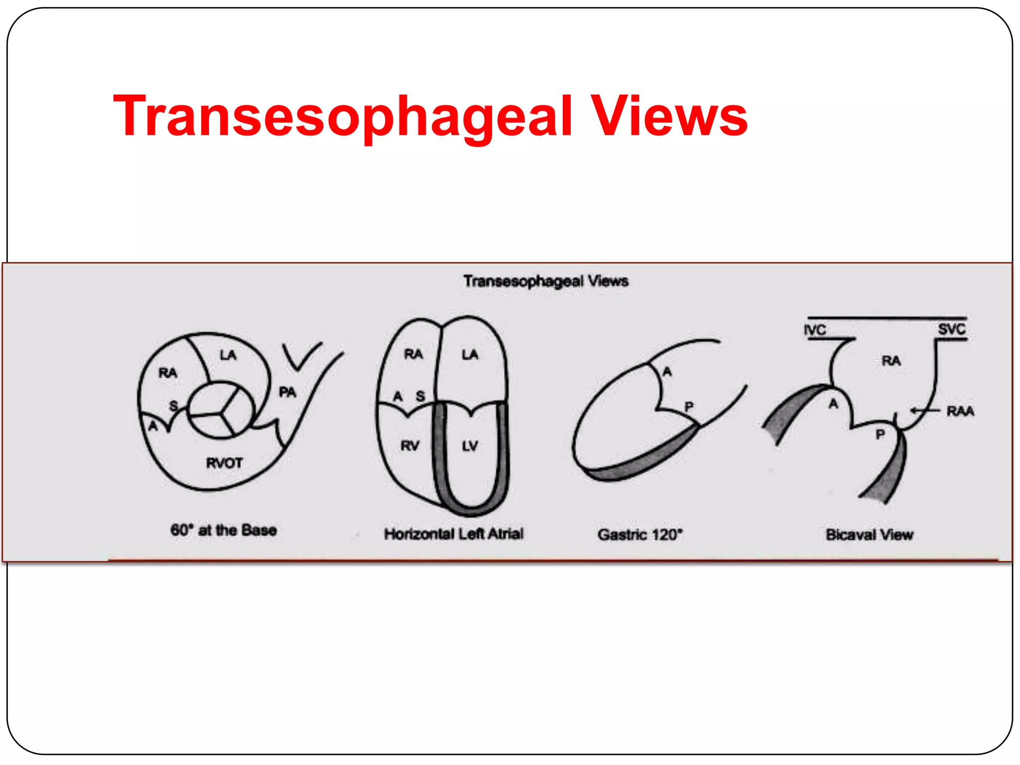 Transesophageal Views
 