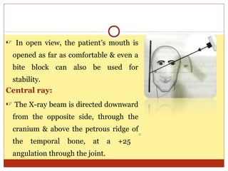 Petrous Ridge Positioning Chart Seminar extra oral radiograph | PPT