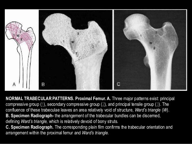 metabolic bone disorders