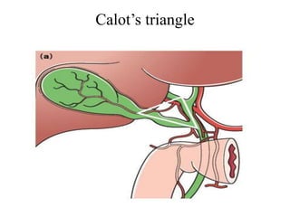 Callot Triangle Border acute biliary infections | PPTX