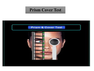 Prism Cover Test
 