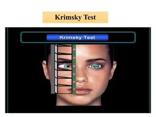 Krimsky Test
 