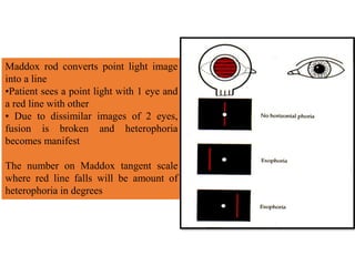 Maddox rod converts point light image
into a line
•Patient sees a point light with 1 eye and
a red line with other
• Due to dissimilar images of 2 eyes,
fusion is broken and heterophoria
becomes manifest
The number on Maddox tangent scale
where red line falls will be amount of
heterophoria in degrees
 