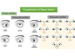 Ocular motility
Examination of Motor Status
Uniocular motility Binocular motility
 