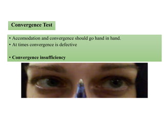 • Accomodation and convergence should go hand in hand.
• At times convergence is defective
• Convergence insufficiency
Convergence Test
 
