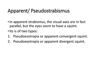Apparent/ Pseudostrabismus
•In apparent strabismus, the visual axes are in fact
parallel, but the eyes seem to have a squint.
•Its is of two types:
1. Pseudoesotropia or apparent convergent squint.
2. Pseudoexotropia or apparent divergent squint.
 