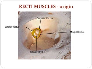 RECTI MUSCLES - origin
Superior Rectus
Lateral Rectus
Medial Rectus
Inferior Rectus
 