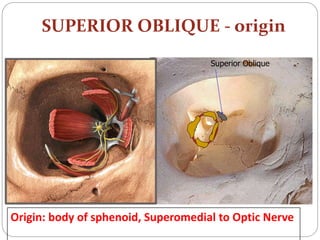 SUPERIOR OBLIQUE - origin
Superior Oblique
Origin: body of sphenoid, Superomedial to Optic Nerve
 