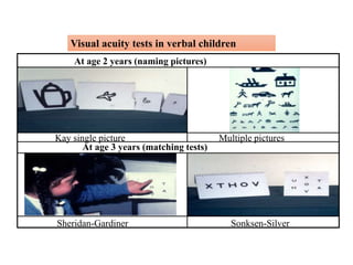 Visual acuity tests in verbal children
Kay single picture Multiple pictures
Sheridan-Gardiner Sonksen-Silver
At age 3 years (matching tests)
At age 2 years (naming pictures)
 