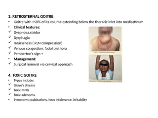Seminargoitre medical pg ms surgery ppt. | PPTX