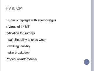 Hallux valgus | PPTX