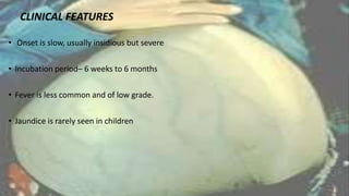 CLINICAL FEATURES
• Onset is slow, usually insidious but severe
• Incubation period– 6 weeks to 6 months
• Fever is less common and of low grade.
• Jaundice is rarely seen in children
 
