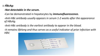 .iii HBcAg:
-Not detectable in the serum.
-Can be demonstrated in hepatocytes by immunofluorescence.
-Anti-HBc antibody usually appears in serum 1-2 weeks after the appearance
of HBsAg.
-Anti-HBc antibody is the earliest antibody to appear in the blood.
-It remains lifelong and thus serves as a useful indicator of prior infection with
HBV.
 