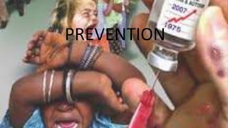 PREVENTION
 