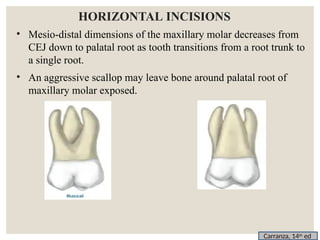 Horizontal Incision Acl Instruments , incisons and basics of flap design for periodontal ...