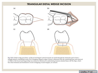 Instruments , incisons and basics of flap design for periodontal ...