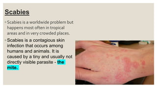 Scabies
◦ Scabies is a worldwide problem but
happens most often in tropical
areas and in very crowded places.
◦ Scabies is a contagious skin
infection that occurs among
humans and animals. It is
caused by a tiny and usually not
directly visible parasite - the
mite.
 