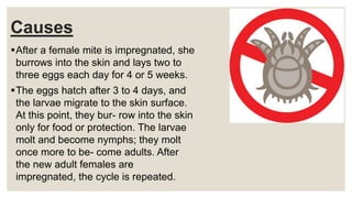 Causes
After a female mite is impregnated, she
burrows into the skin and lays two to
three eggs each day for 4 or 5 weeks.
The eggs hatch after 3 to 4 days, and
the larvae migrate to the skin surface.
At this point, they bur- row into the skin
only for food or protection. The larvae
molt and become nymphs; they molt
once more to be- come adults. After
the new adult females are
impregnated, the cycle is repeated.
 