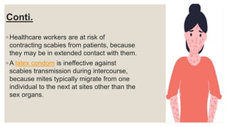 Conti.
◦ Healthcare workers are at risk of
contracting scabies from patients, because
they may be in extended contact with them.
◦ A latex condom is ineffective against
scabies transmission during intercourse,
because mites typically migrate from one
individual to the next at sites other than the
sex organs.
 