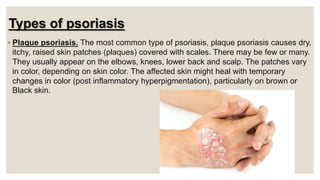 Types of psoriasis
◦ Plaque psoriasis. The most common type of psoriasis, plaque psoriasis causes dry,
itchy, raised skin patches (plaques) covered with scales. There may be few or many.
They usually appear on the elbows, knees, lower back and scalp. The patches vary
in color, depending on skin color. The affected skin might heal with temporary
changes in color (post inflammatory hyperpigmentation), particularly on brown or
Black skin.
 