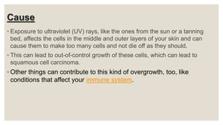 Cause
◦ Exposure to ultraviolet (UV) rays, like the ones from the sun or a tanning
bed, affects the cells in the middle and outer layers of your skin and can
cause them to make too many cells and not die off as they should.
◦ This can lead to out-of-control growth of these cells, which can lead to
squamous cell carcinoma.
◦ Other things can contribute to this kind of overgrowth, too, like
conditions that affect your immune system.
 