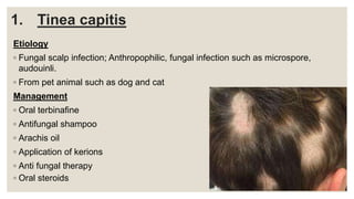 1. Tinea capitis
Etiology
◦ Fungal scalp infection; Anthropophilic, fungal infection such as microspore,
audouinli.
◦ From pet animal such as dog and cat
Management
◦ Oral terbinafine
◦ Antifungal shampoo
◦ Arachis oil
◦ Application of kerions
◦ Anti fungal therapy
◦ Oral steroids
 