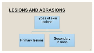 LESIONS AND ABRASIONS
Types of skin
lesions
Primary lesions
Secondary
lesions
23
 