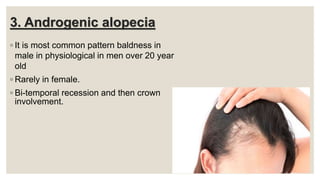 3. Androgenic alopecia
◦ It is most common pattern baldness in
male in physiological in men over 20 year
old
◦ Rarely in female.
◦ Bi-temporal recession and then crown
involvement.
 