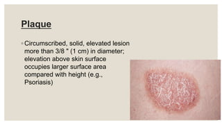 Plaque
◦ Circumscribed, solid, elevated lesion
more than 3/8 " (1 cm) in diameter;
elevation above skin surface
occupies larger surface area
compared with height (e.g.,
Psoriasis)
 