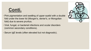 Conti.
◦ Pink pigmentation and swelling of upper eyelid with a double
fold under the lower lid (Morgan's, denier's, or Mongolian
fold) due to severe pruritus.
◦ Viral, fungal, or bacterial infections and ocular disorders
(common secondary conditions).
◦ Serum IgE levels (often elevated but not diagnostic).
 