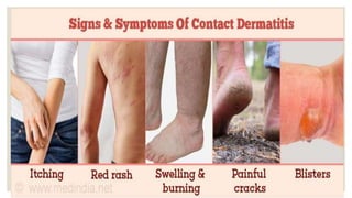 Signs and symptoms
 