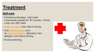 Treatment
Self-care
• If blistering develops, cold moist
compresses applied for 30 minutes, 3 times
a day can offer relief.
• Calamine lotion may relieve itching.
• Oral antihistamines such
as diphenhydramine (Benadryl, ben-
allergen) can relieve itching.
• Avoid scratching.
 