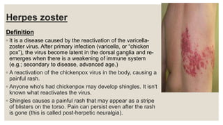 Herpes zoster
Definition
◦ It is a disease caused by the reactivation of the varicella-
zoster virus. After primary infection (varicella, or “chicken
pox”), the virus become latent in the dorsal ganglia and re-
emerges when there is a weakening of immune system
(e.g.; secondary to disease, advanced age.)
◦ A reactivation of the chickenpox virus in the body, causing a
painful rash.
◦ Anyone who's had chickenpox may develop shingles. It isn't
known what reactivates the virus.
◦ Shingles causes a painful rash that may appear as a stripe
of blisters on the torso. Pain can persist even after the rash
is gone (this is called post-herpetic neuralgia).
 