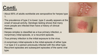 Conti.
◦ About 85% of adults worldwide are seropositive for herpes type
1.
◦ The prevalence of type 2 is lower; type 2 usually appears at the
onset of sexual activity. Serologic testing shows that many
more people are infected than have a history of clinical
disease.
◦ Herpes simplex is classified as a true primary infection, a
nonprimary initial episode, or a recurrent episode.
◦ True primary infection is the initial exposure to the virus.
◦ A nonprimary initial episode is the initial episode of either type
1 or type 2 in a person previously infected with the other type.
Recurrent episodes are subsequent episodes of the same viral
type.
 