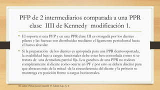 PFP de 2 intermediarios comparada a una PPR
clase IIII de Kennedy modificación 1.
• El soporte n una PFP y en una PPR clase III es otorgada por los dientes
pilares y las fuerzas son distribuidas mediante el ligamento periodontal hacia
el hueso alveolar.
• Si la preparación de los dientes es apropiada para una PPR dentosoportada,
la estabilidad bajo a cargas funcionales debe estar ben controlada como si se
tratara de una dentadura parcial fija. Los ganchos de una PPR no rodean
completamente al diente como ocurre en PF y por esto se deben diseñar para
que abracen más de la mitad de la circunferencia del diente y la prótesis se
mantenga en posición frente a cargas horizontales.
Mc craken: Prótesis parcial removible 11 Edición Cap. 2 y 4.
 