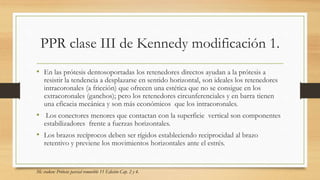 PPR clase III de Kennedy modificación 1.
• En las prótesis dentosoportadas los retenedores directos ayudan a la prótesis a
resistir la tendencia a desplazarse en sentido horizontal, son ideales los retenedores
intracoronales (a fricción) que ofrecen una estética que no se consigue en los
extracoronales (ganchos); pero los retenedores circunferenciales y en barra tienen
una eficacia mecánica y son más económicos que los intracoronales.
• Los conectores menores que contactan con la superficie vertical son componentes
estabilizadores frente a fuerzas horizontales.
• Los brazos recíprocos deben ser rígidos estableciendo reciprocidad al brazo
retentivo y previene los movimientos horizontales ante el estrés.
Mc craken: Prótesis parcial removible 11 Edición Cap. 2 y 4.
 