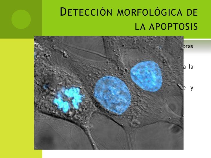 DNA fragmentation and cell cycle arrest: a hallmark of apoptosis induâ€¦