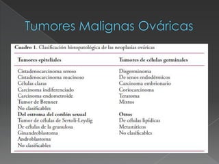 Tumores Malignas Ováricas<br />