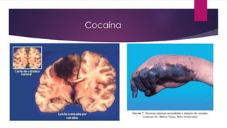 Cocaína
 